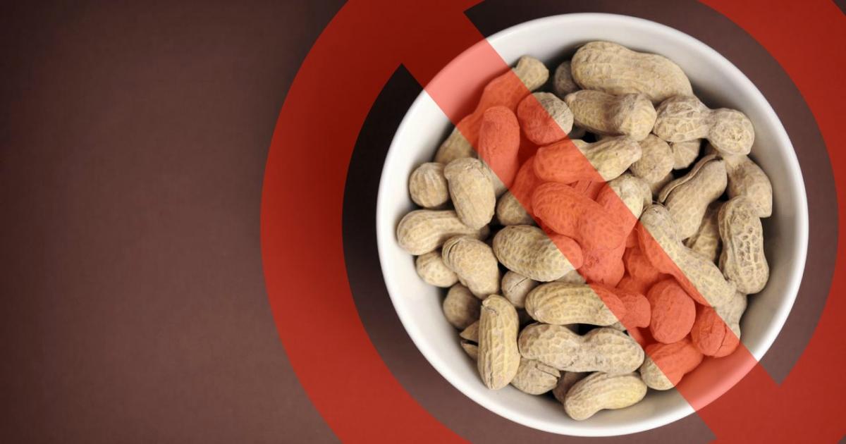 Vivre avec les allergies, partie 1: shit, mon enfant a des allergies alimentaires