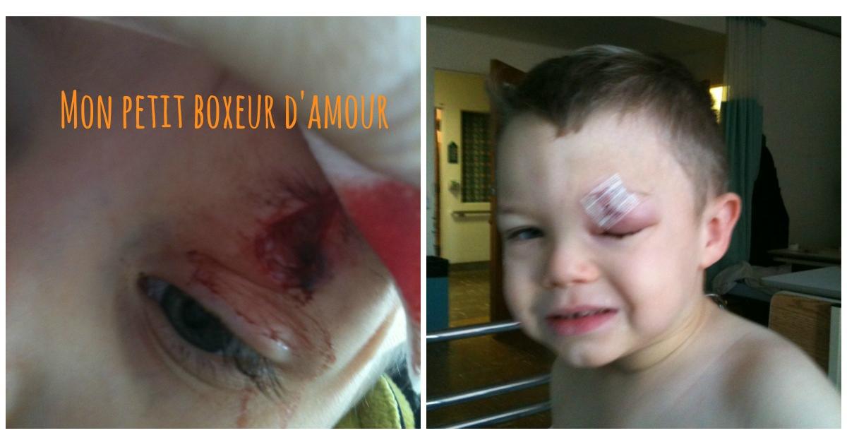 Enfant casse-cou : ça n'arrive qu'à mon fils!
