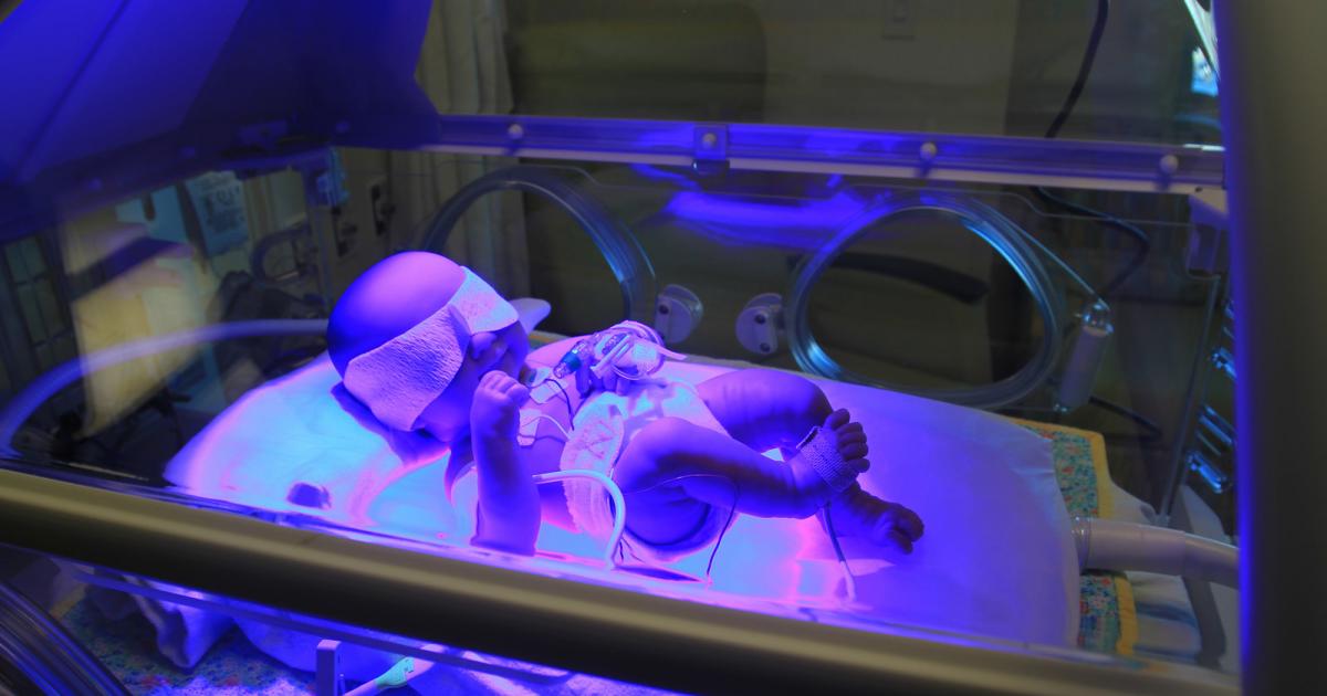 La naissance d’une petite pressée – Partie 3 : séjour à l’unité néonatale