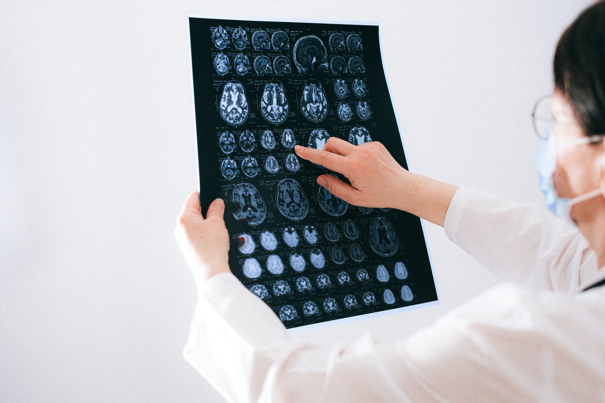 Mon médecin pensait que j’avais un cancer au cerveau [Partie 1]